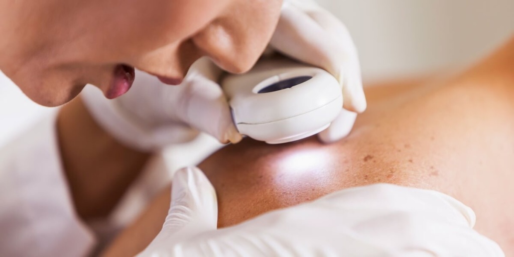 Дерматовенеролог бронницы Дерматовенеролог бронницы