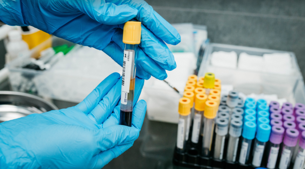 Сдать анализы в Бронницах Сдать анализы в Бронницах